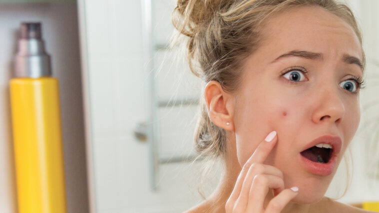 skin-conditions-kids-deal-with