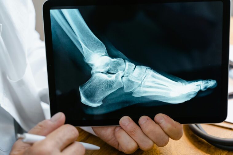 Alt: person showing x-ray image of foot, courtesy of Pexels