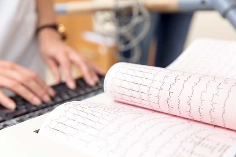 electrocardiogram - Central Florida Lifestyle